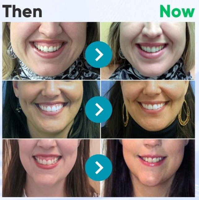 🐝Rolimey® VioCore Zahnpasta mit Bienengift zur Zahnbehandlung