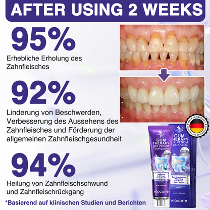 🐝Rolimey® VioCore Zahnpasta mit Bienengift zur Zahnbehandlung