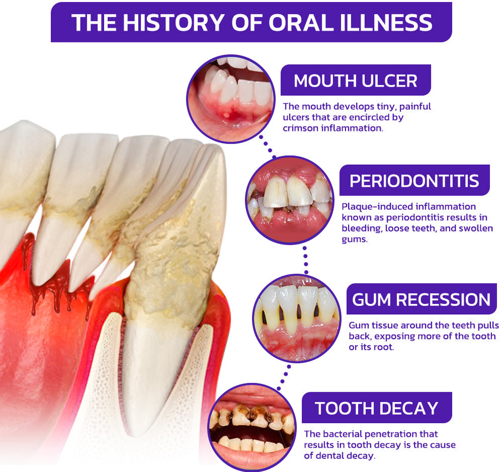 🐝Rolimey® VioCore Zahnpasta mit Bienengift zur Zahnbehandlung