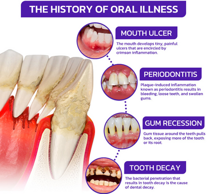 🐝Rolimey® VioCore Zahnpasta mit Bienengift zur Zahnbehandlung